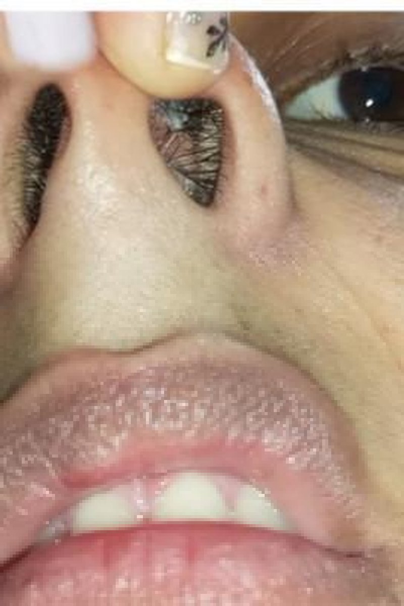 TP-manyvidsmelissa16-my-nose-in-close-up-for-you